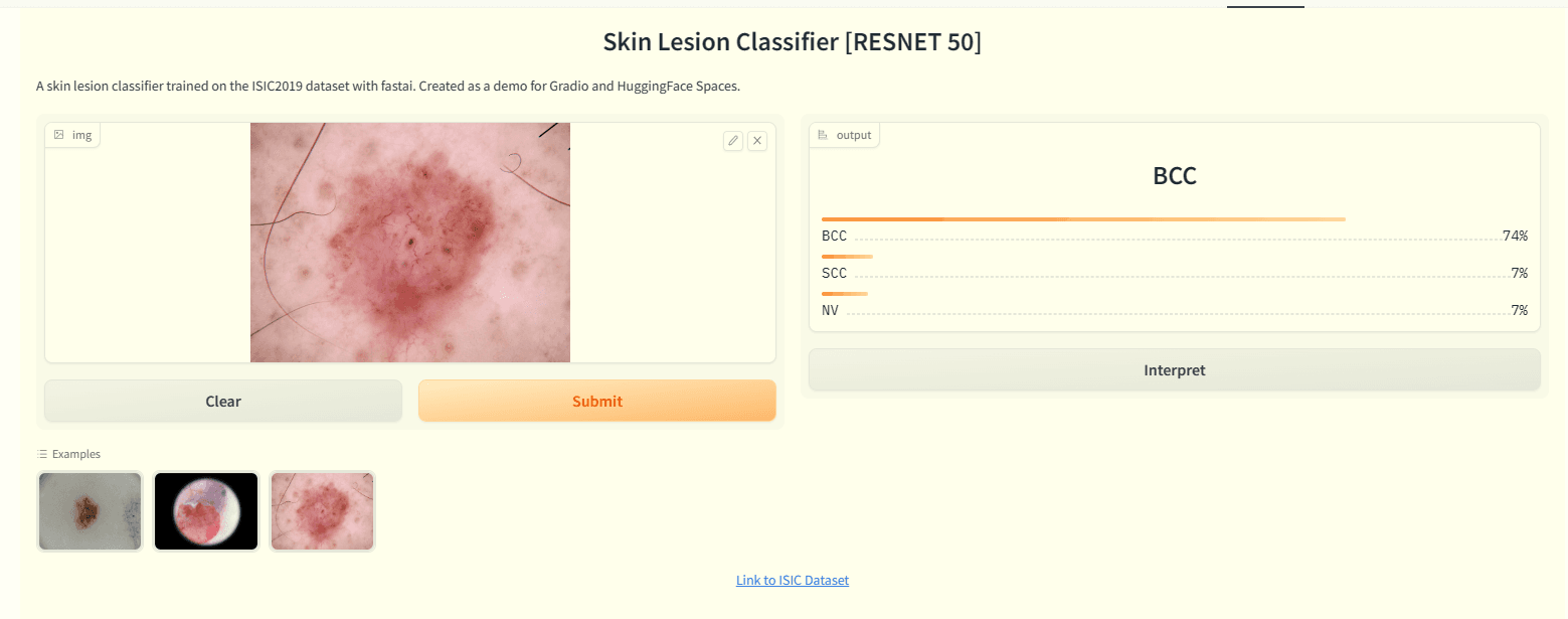 I S I C - Skin Lesion Classification Models - Reseacrh Paper